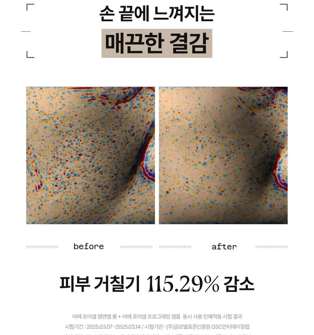 [1+1 NMN 급속모공앰플] 아떼 포어셀 프로그래밍 앰플 듀오 기획 상세페이지 30